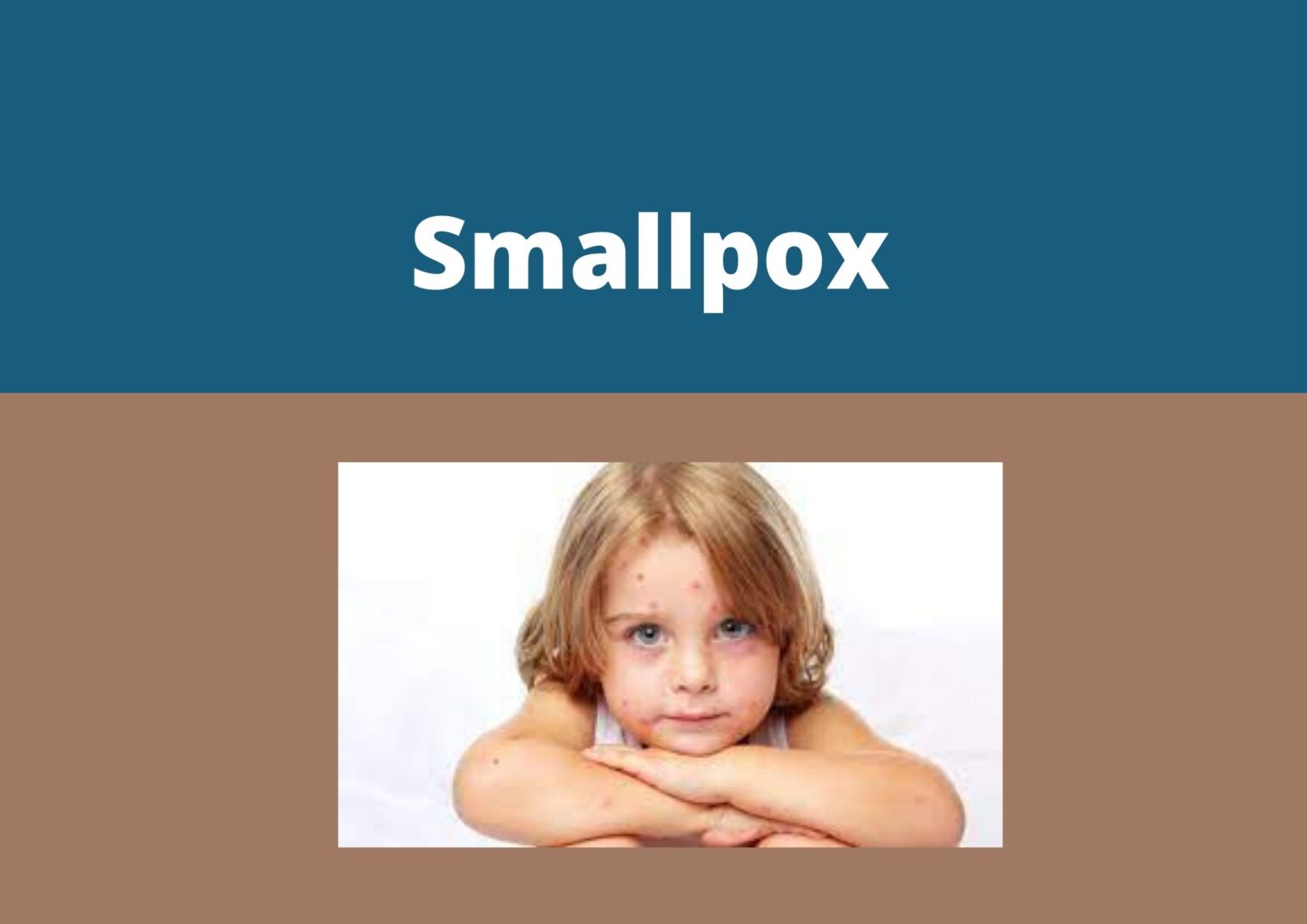 smallpox-my-vision-of-health