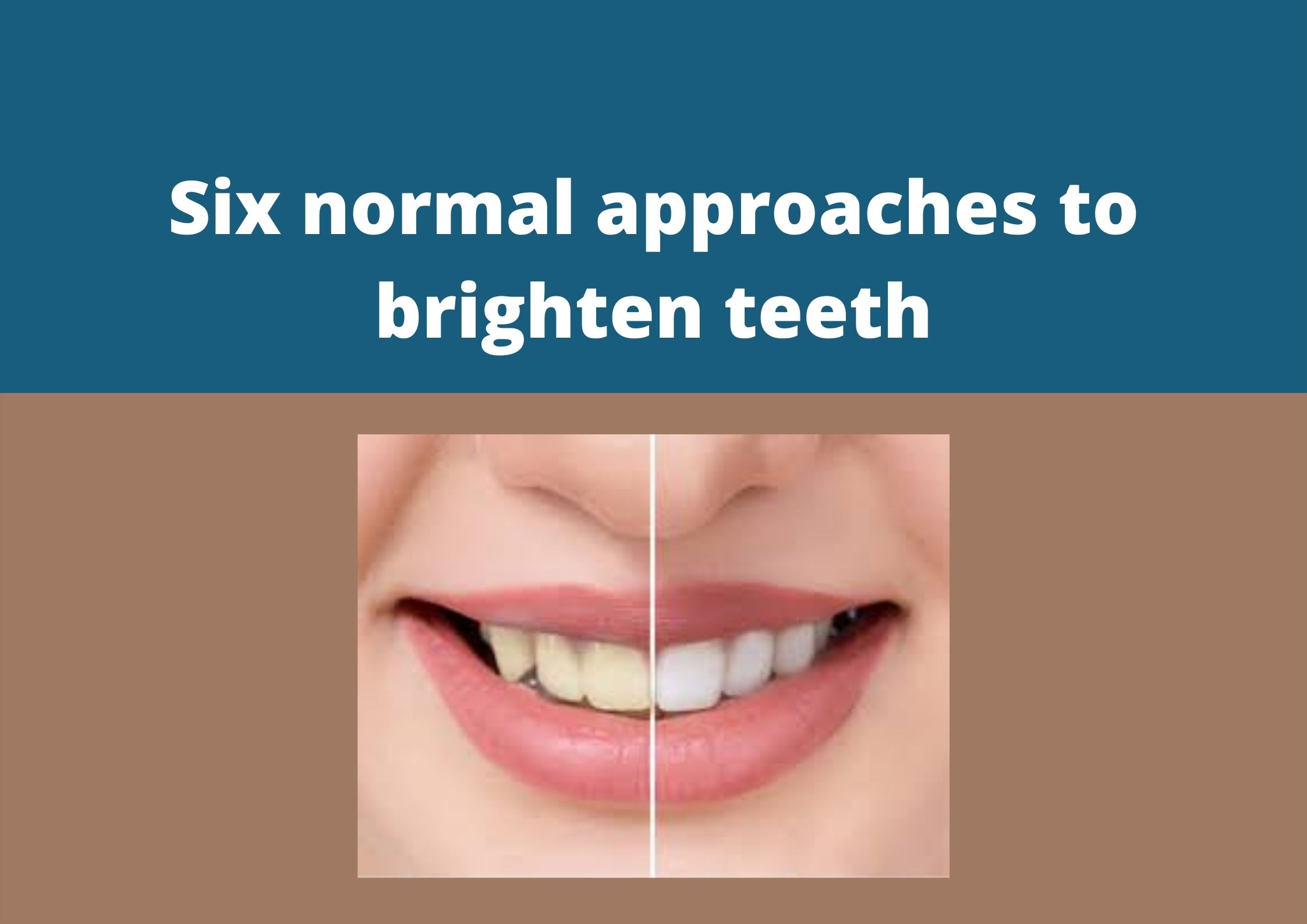 Six normal approaches to brighten teeth